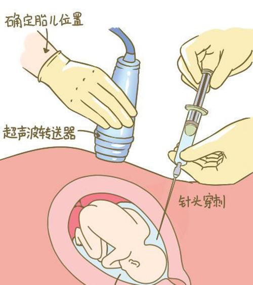 凉山羊水孕期亲子鉴定