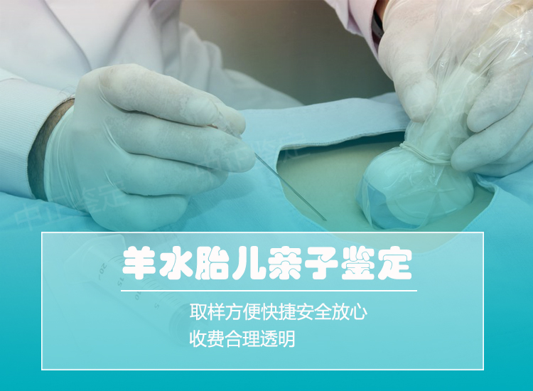 凉山羊水孕期亲子鉴定